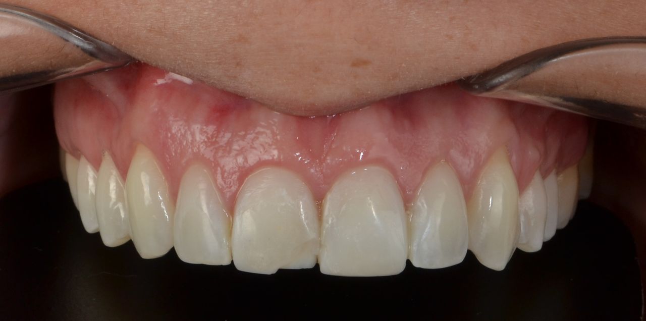 Francisco Jose Vives Serrano-10