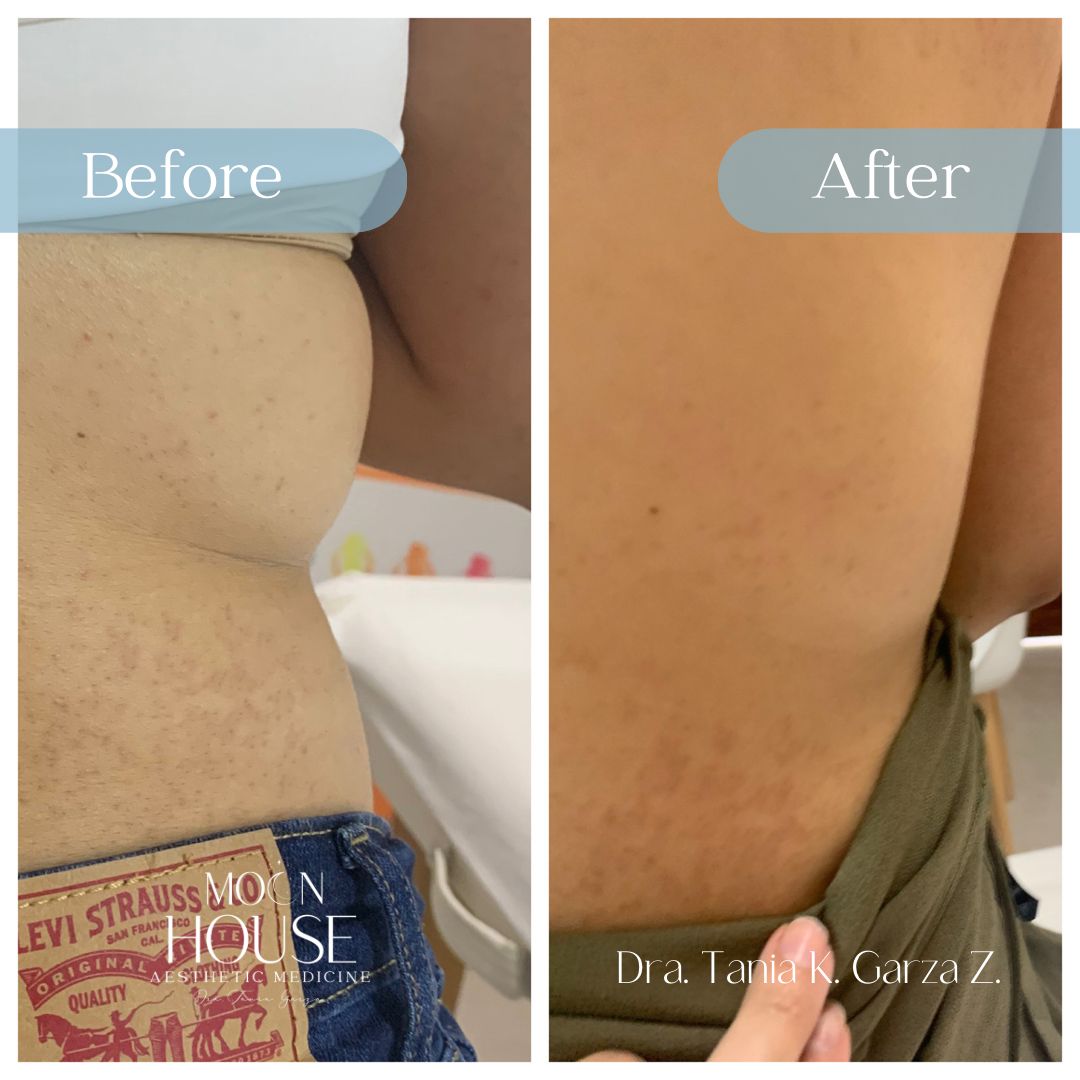 Tania Karine Garza Zepeda-18