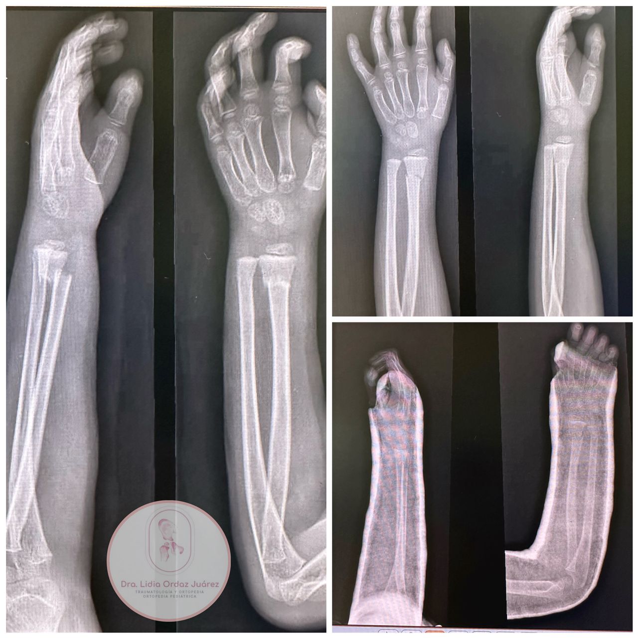 Lidia Ordaz Juárez-26