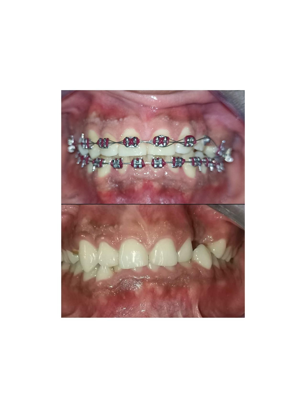 Jair Contreras García-21