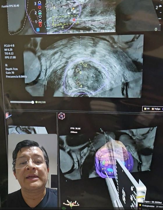 Efrain Barradas Huervo-1