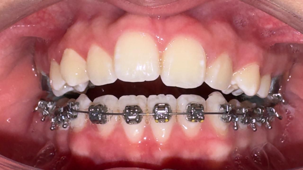 Miguel Angel Garita Cruz-8