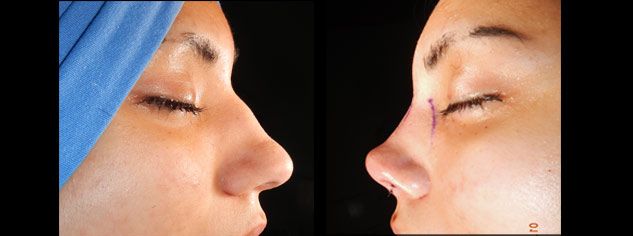 Edgar Ernesto Torres Mejía-42