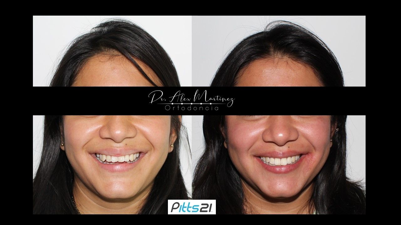 Alejandro Martínez Hernández-0