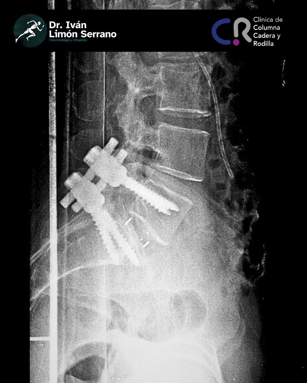 Iván Limón Serrano-31