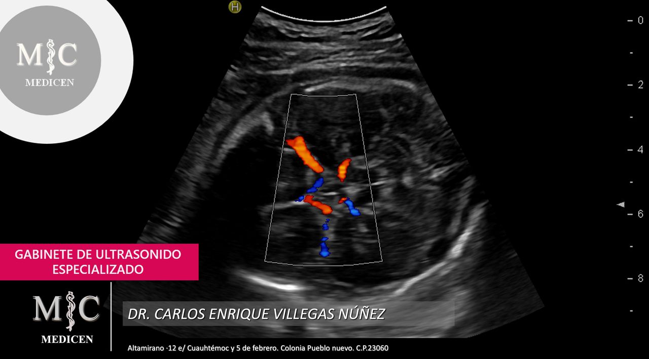 Carlos Enrique Villegas Nuñez-17