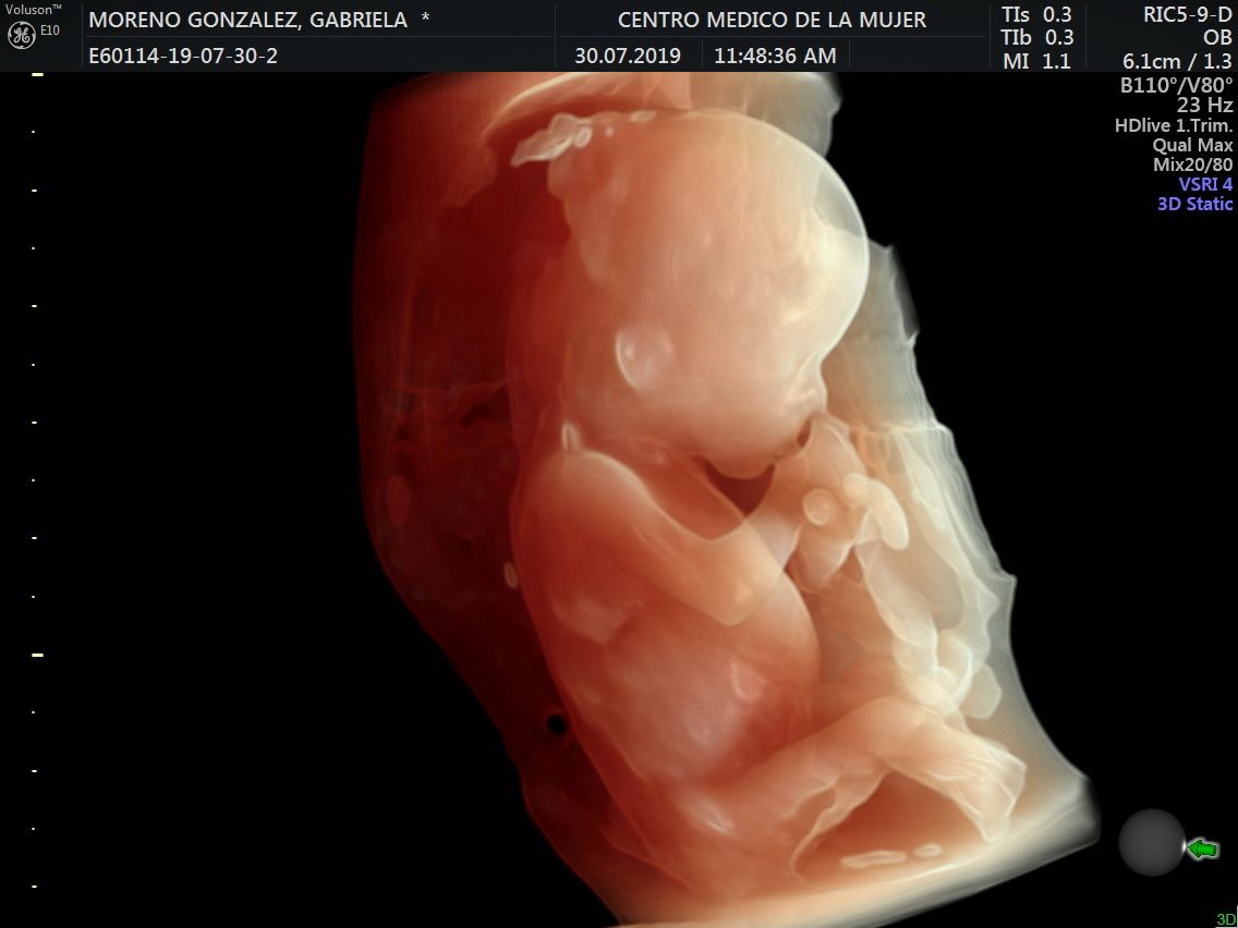 Julio Cesar Monárrez Martín-14