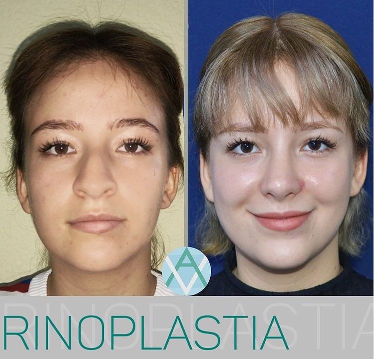 Alfonso Villaseñor Herrero-3