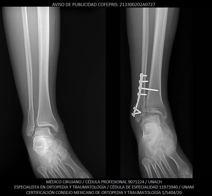 Luis Castañón Robles-12
