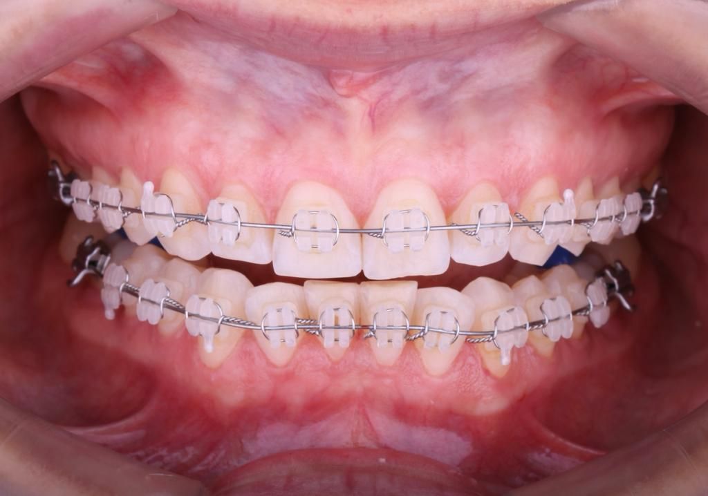 Mirely Peralta Rodríguez-0