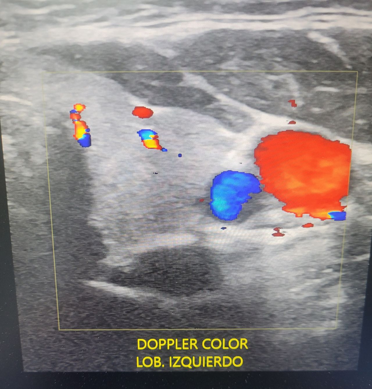 Einar Arik Nuñez Sanchez-10