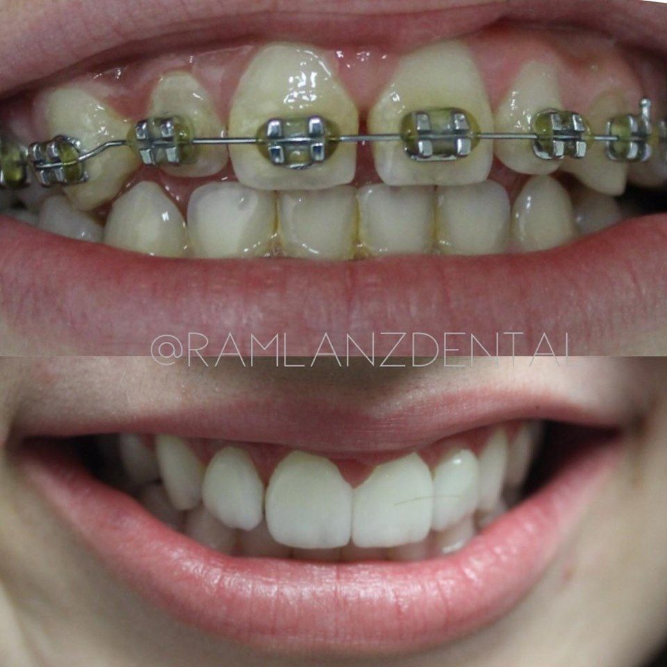 Germán Arturo Ramírez Barreto-16