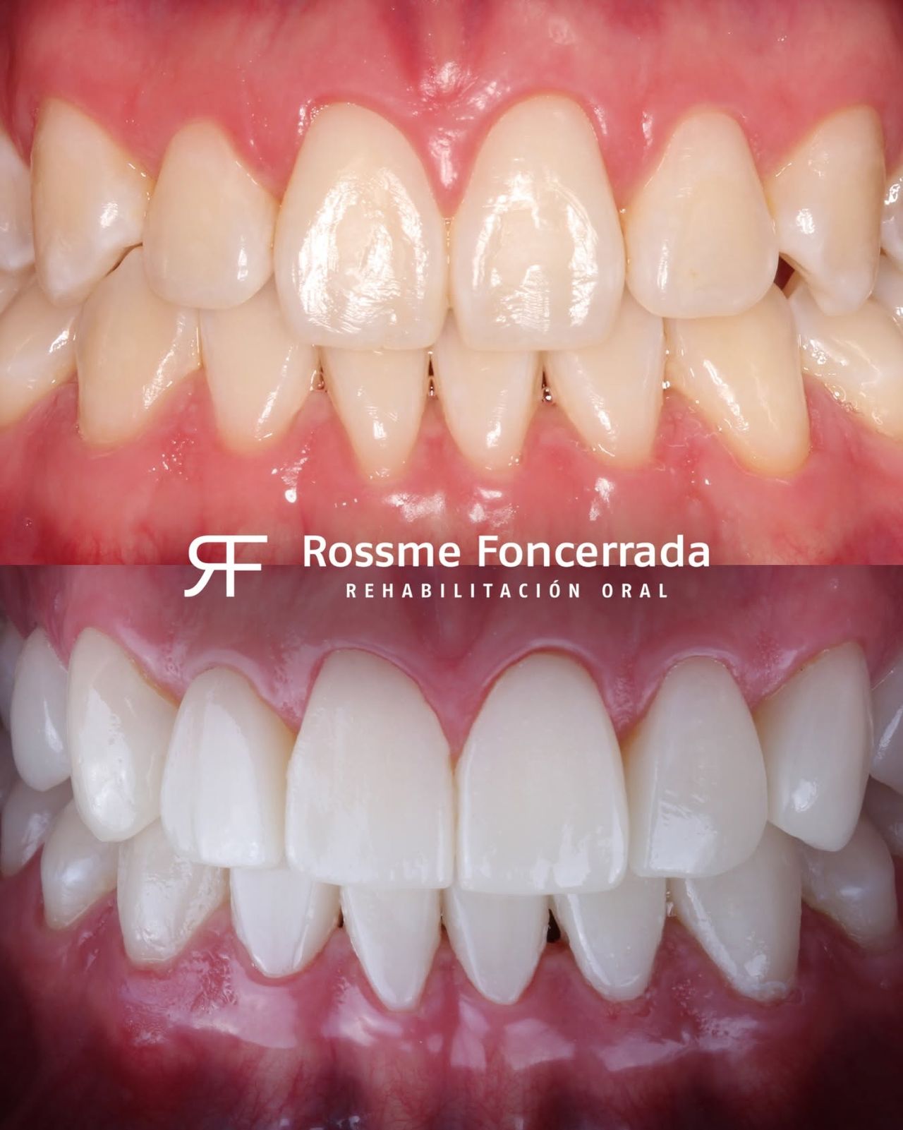 Rossme Foncerrada-16