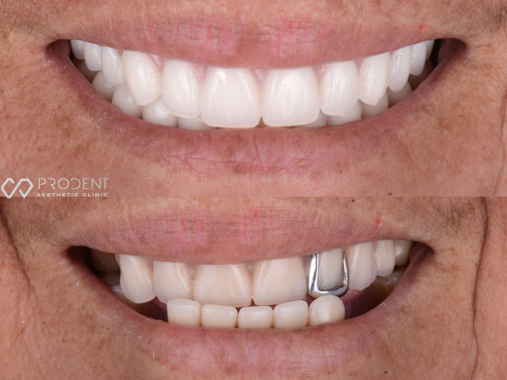 Ulises Pérez Murillo-100