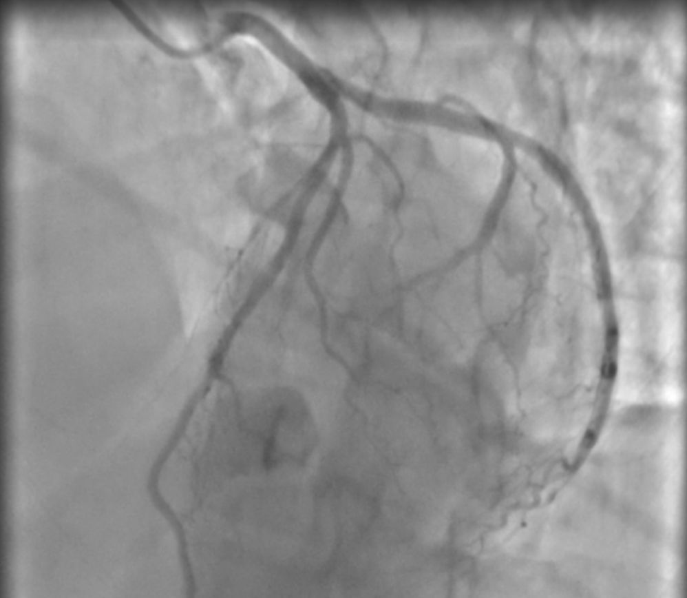 Laura Paola Aceves Chong-3