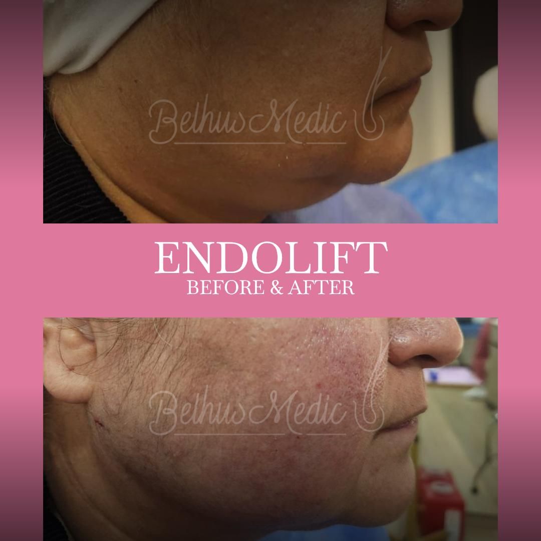 Alejandra Soriano Elorza-85