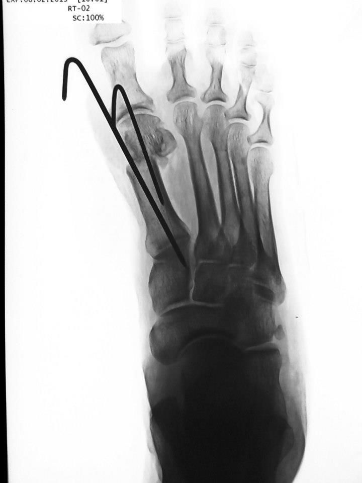 Gerardo Bautista Díaz-12