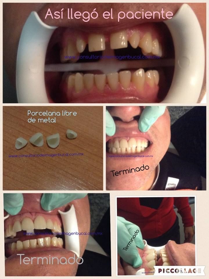 Alfonso Gonzalez Ocaranza-15