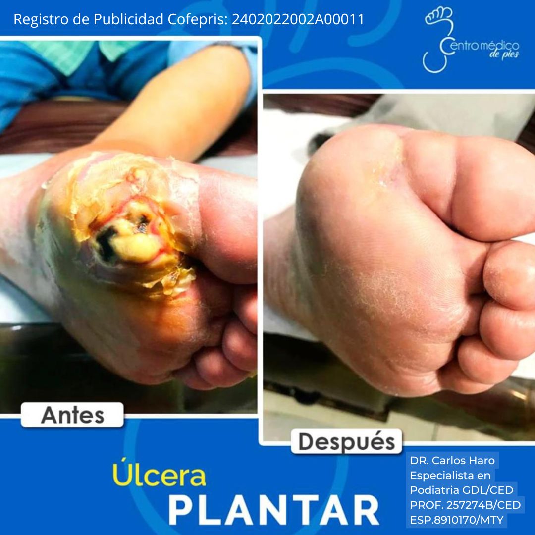 Carlos Alberto Haro Prieto-10