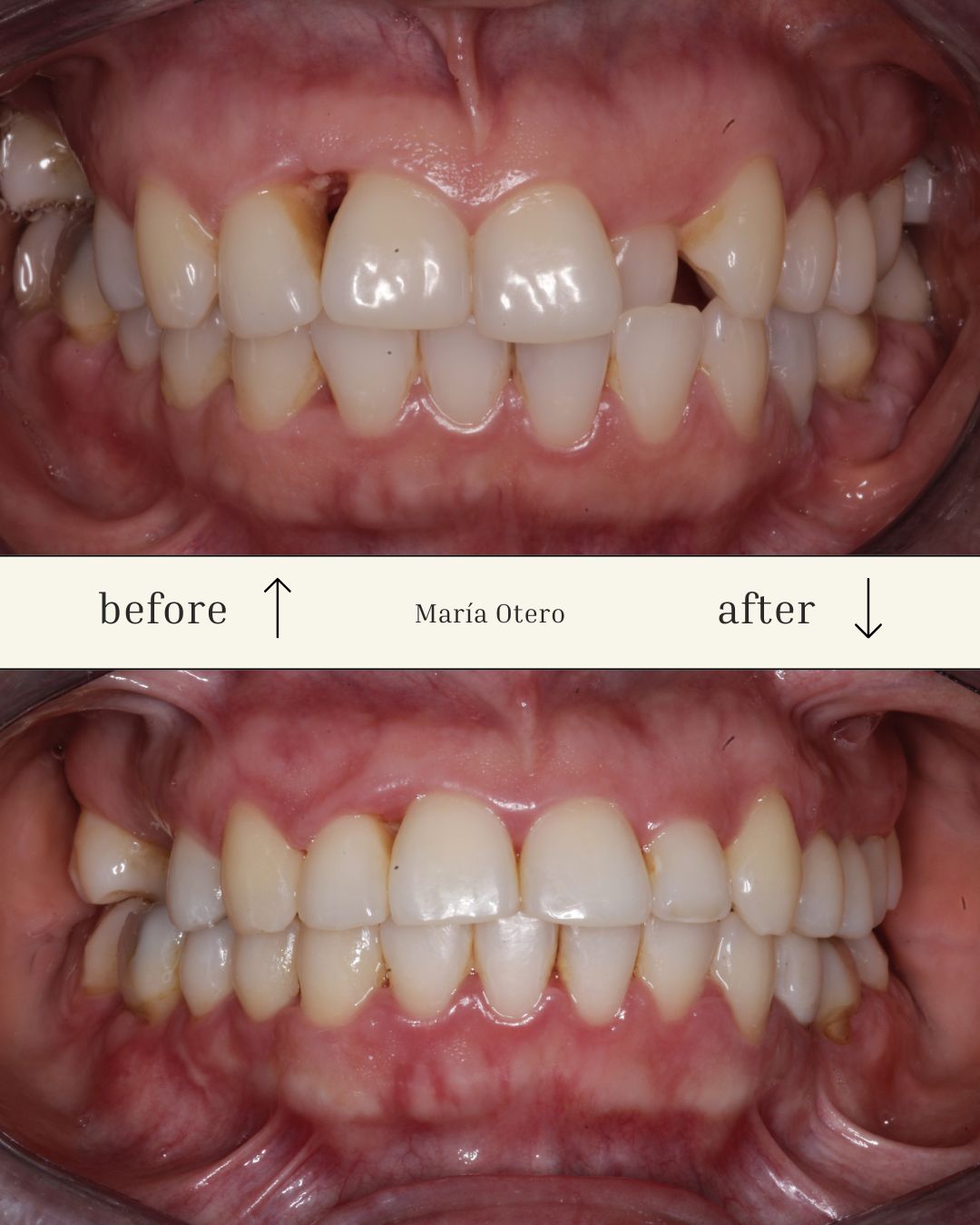 Maria Jesus Otero Lois-10