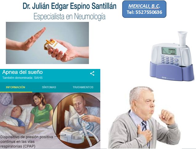 Julián Edgar Espino Santillán-23