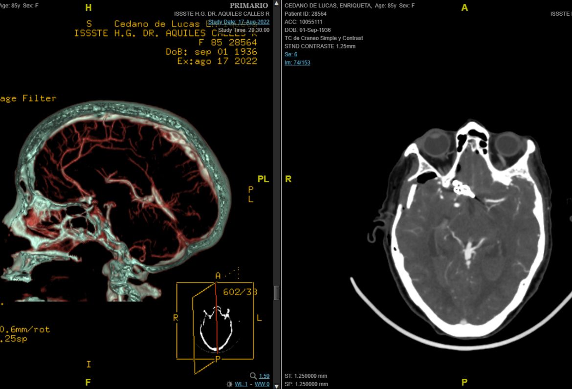 Celia Teresa De Jesús Álvarez Gamiño-27