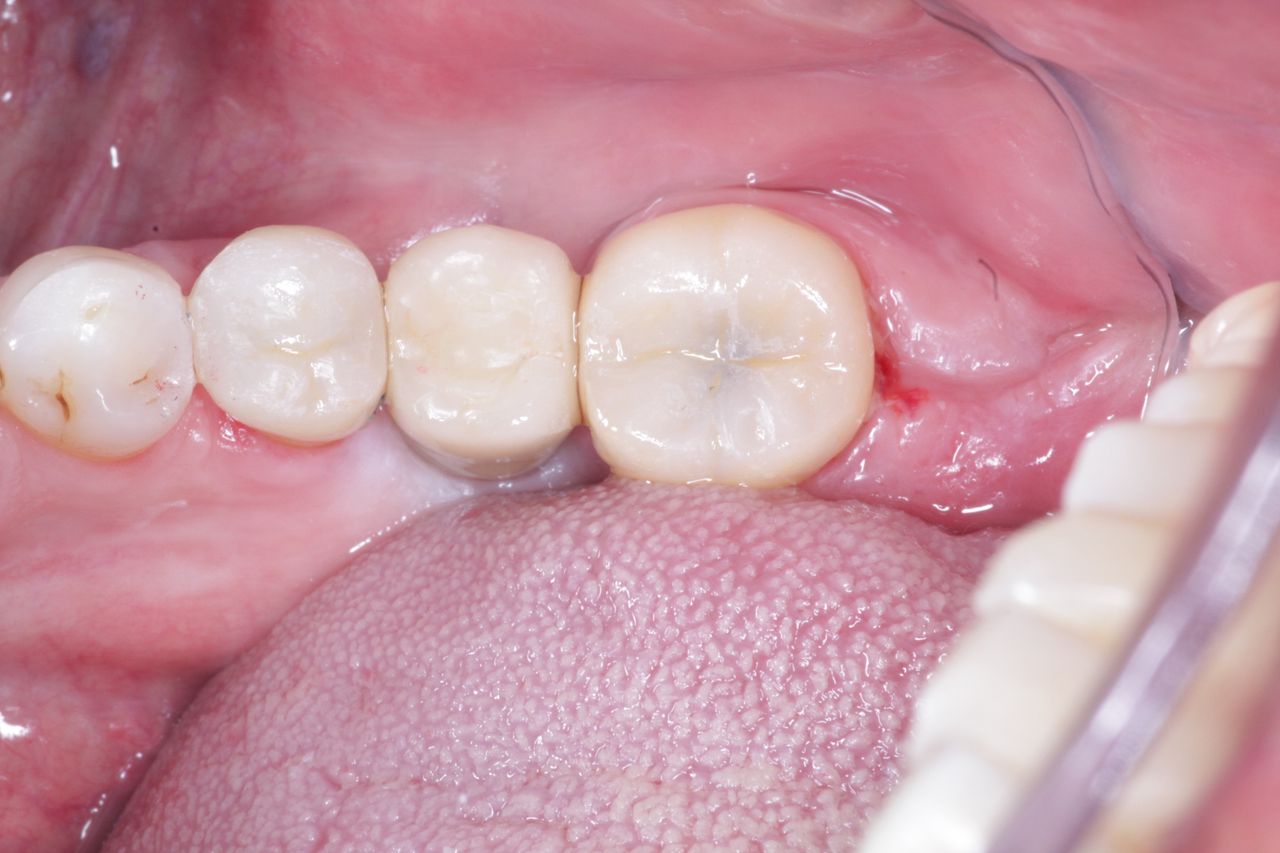 Josué Márquez Gómez-64