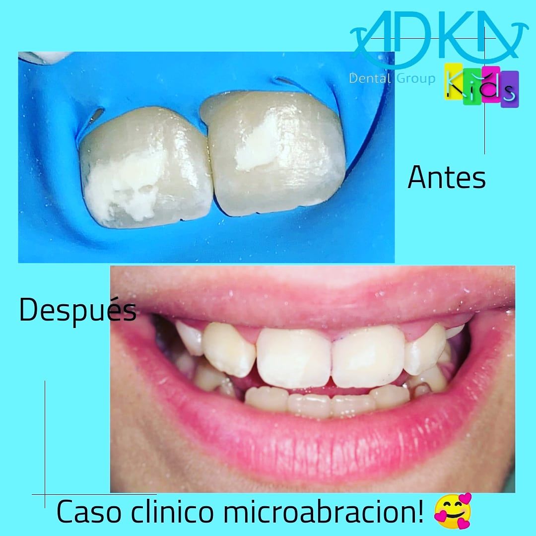 Karla Berenice Lopez Almazan-16