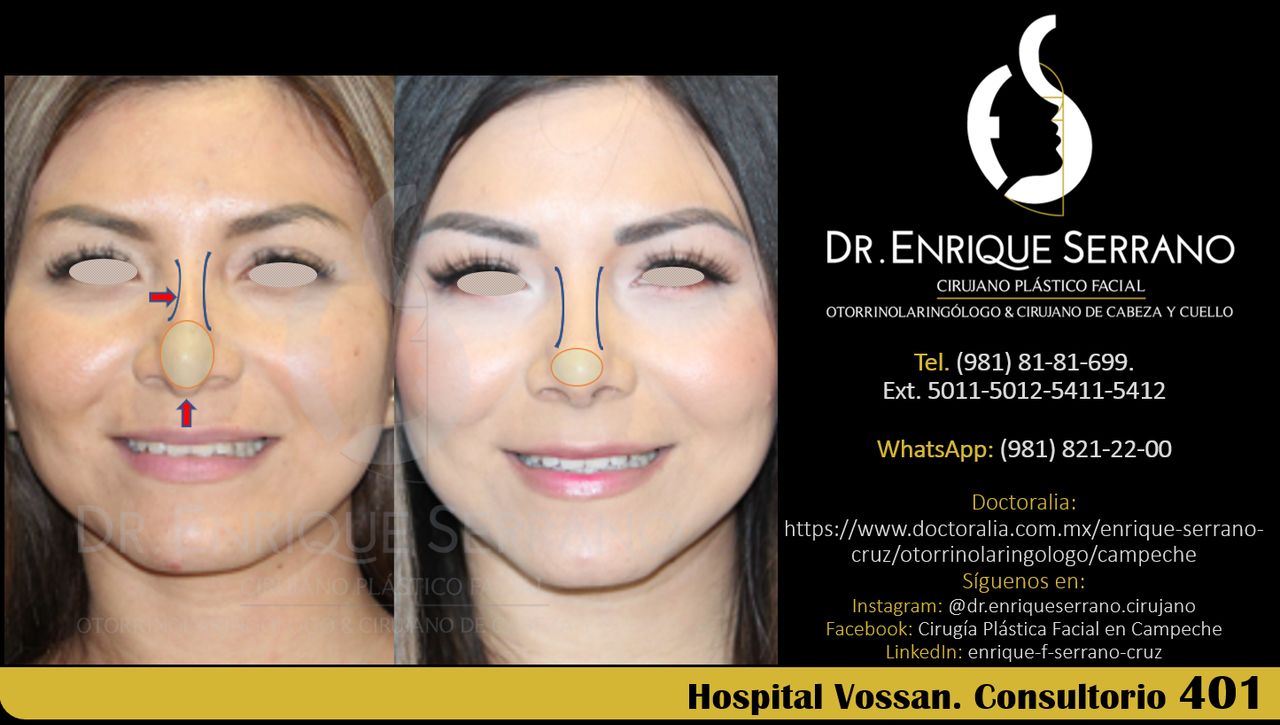 Enrique Serrano Cruz-84