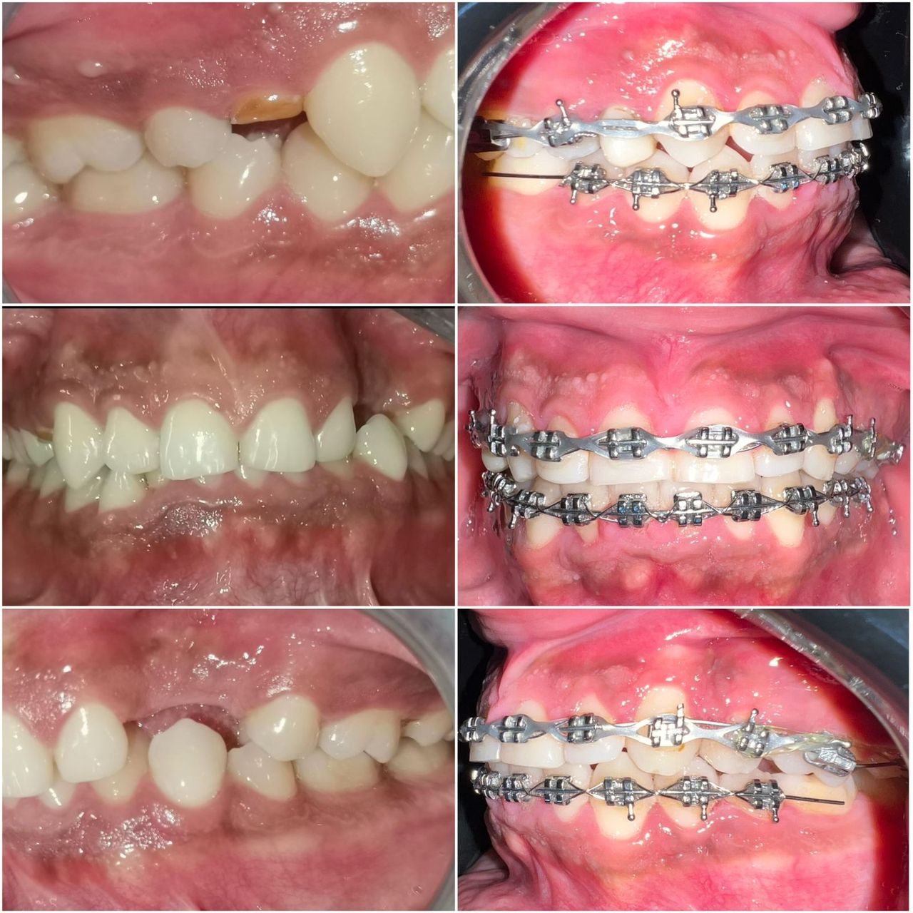 Jair Contreras García-35