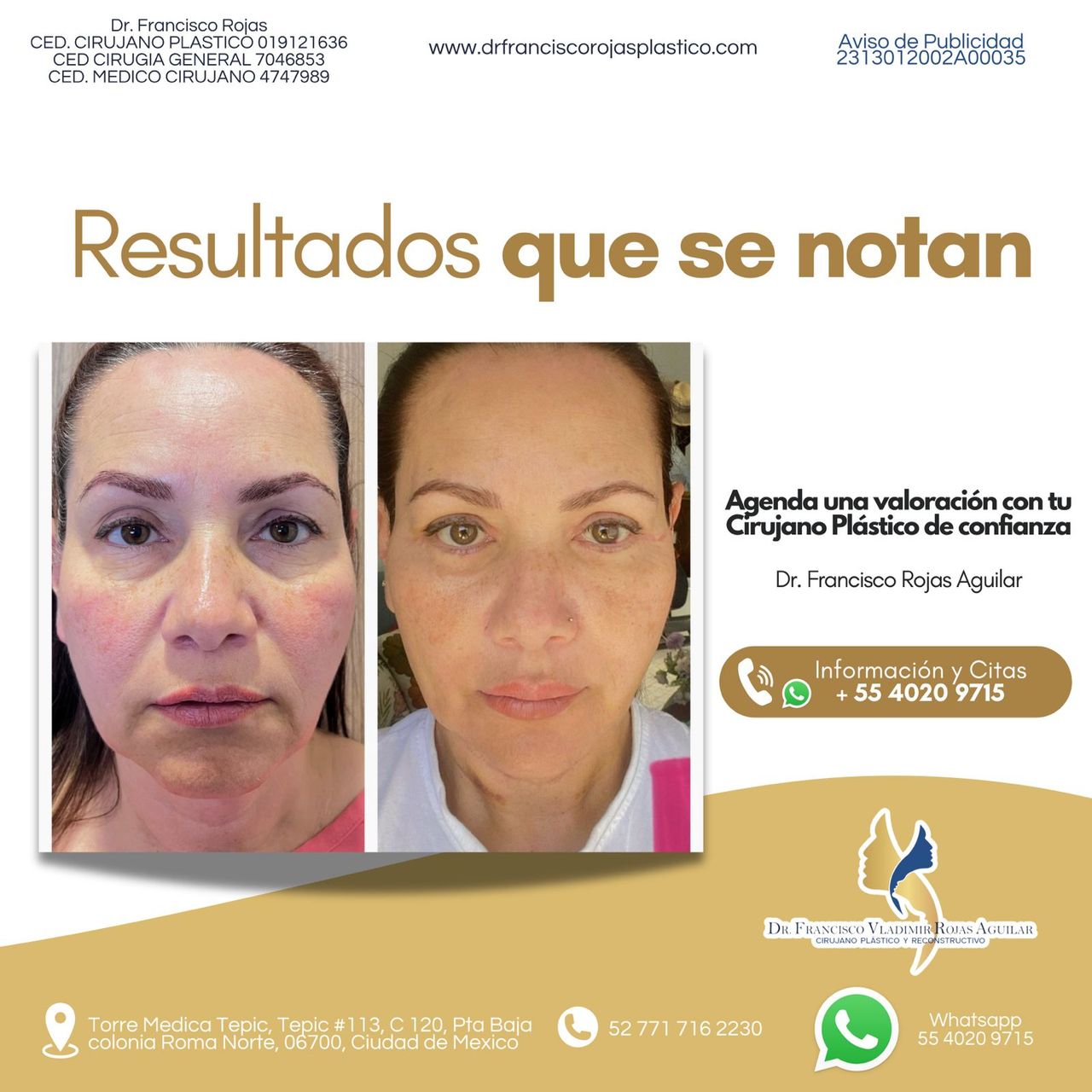 Francisco Rojas Aguilar-29