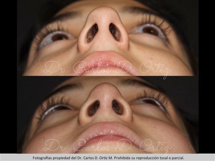 Carlos David Ortiz Moreno-44