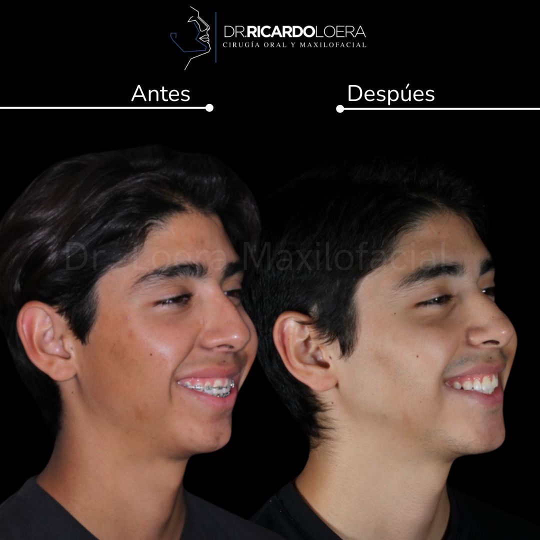 Ricardo Loera Morales-69