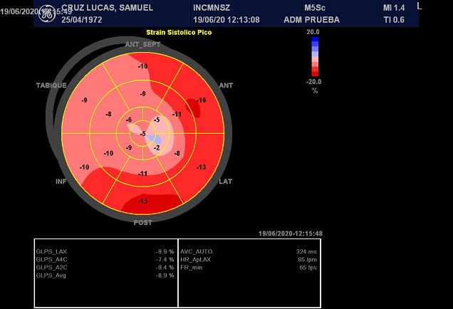 Emmanuel Adrian Lazcano Diaz-6