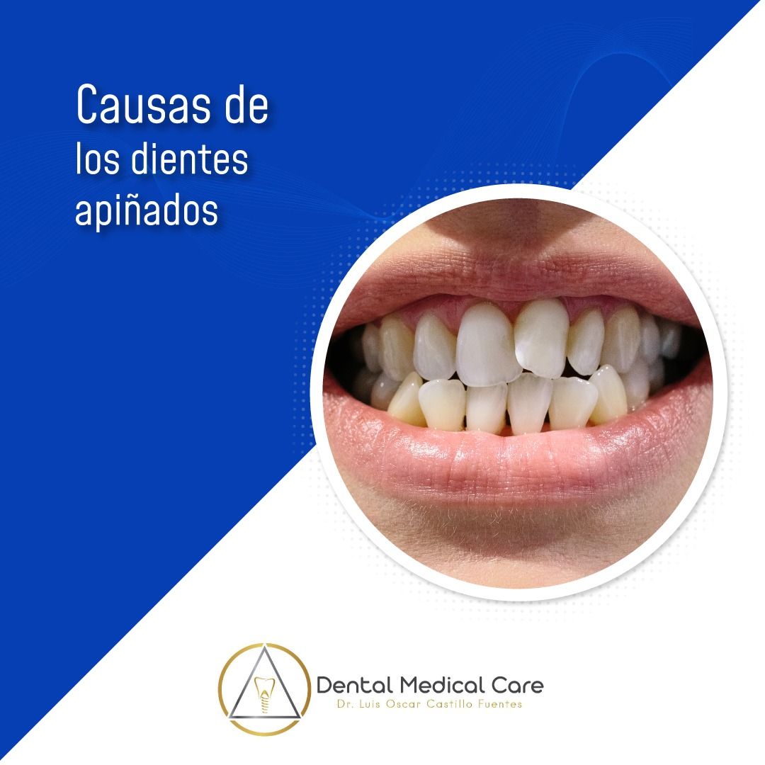 Luis Oscar Castillo Fuentes-1