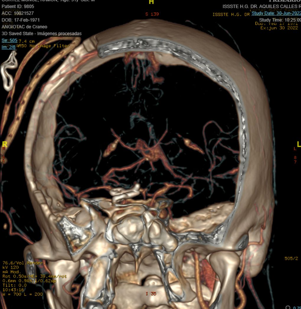 Celia Teresa De Jesús Álvarez Gamiño-26