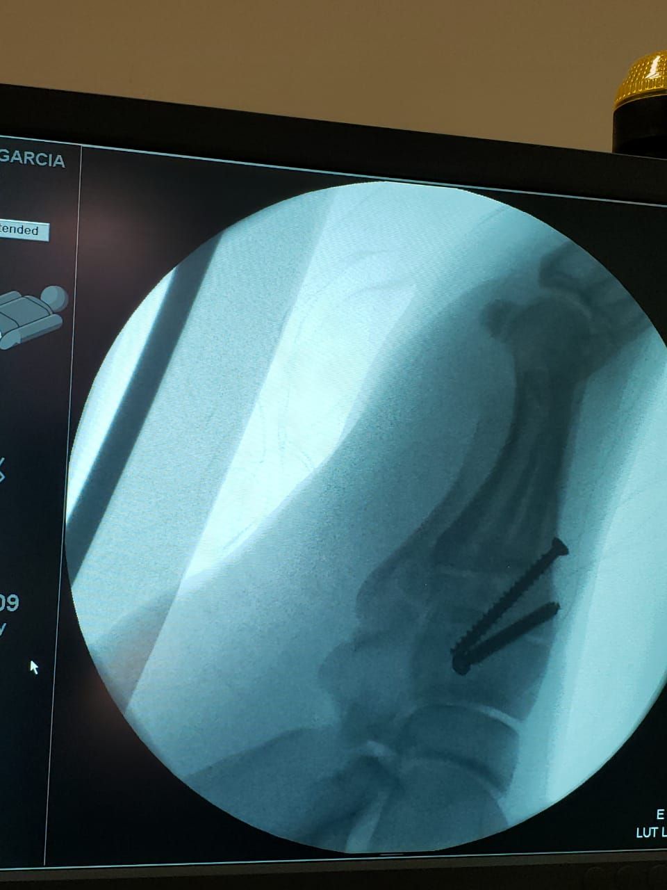 Victor Manuel Valdez Tapia-1