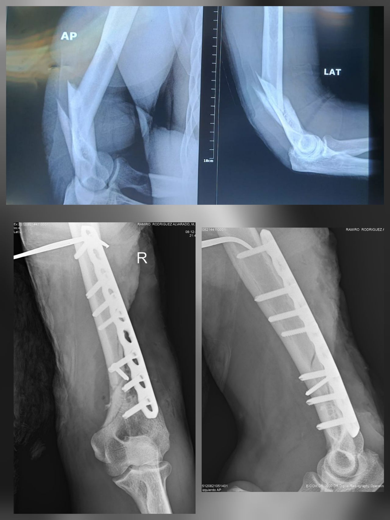Amando Ramirez Zavala-7