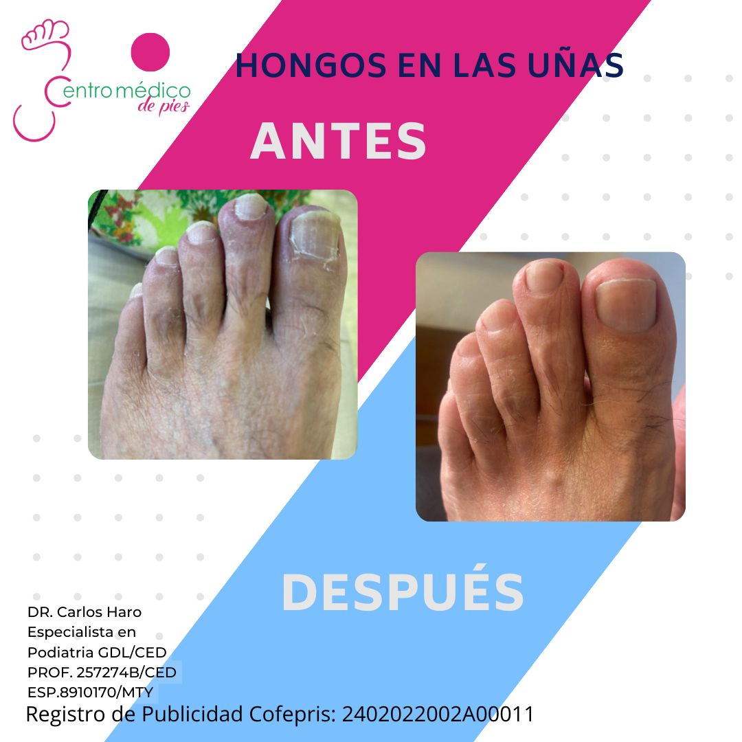 Carlos Alberto Haro Prieto-14