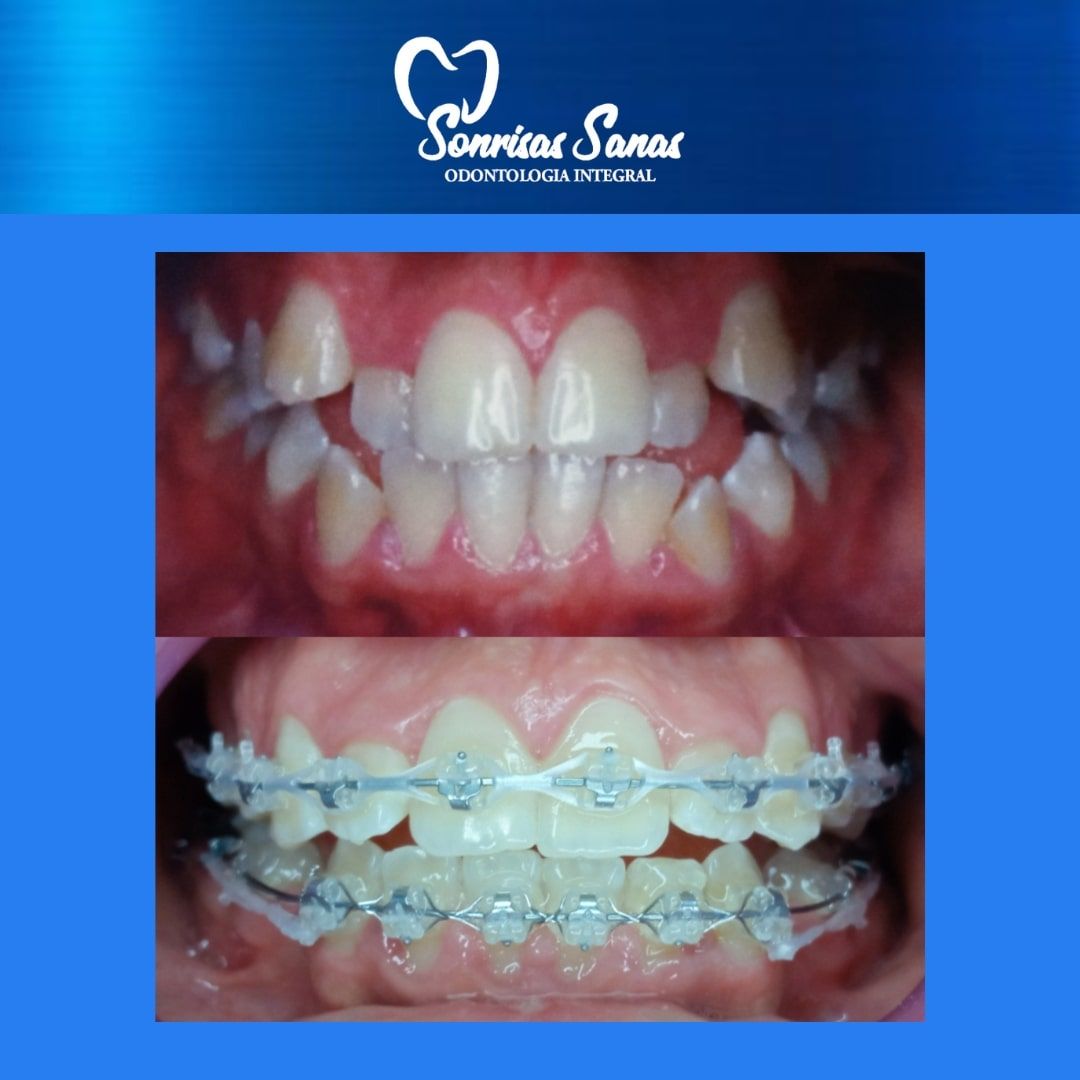 Jacqueline Nuñez Herrera-0