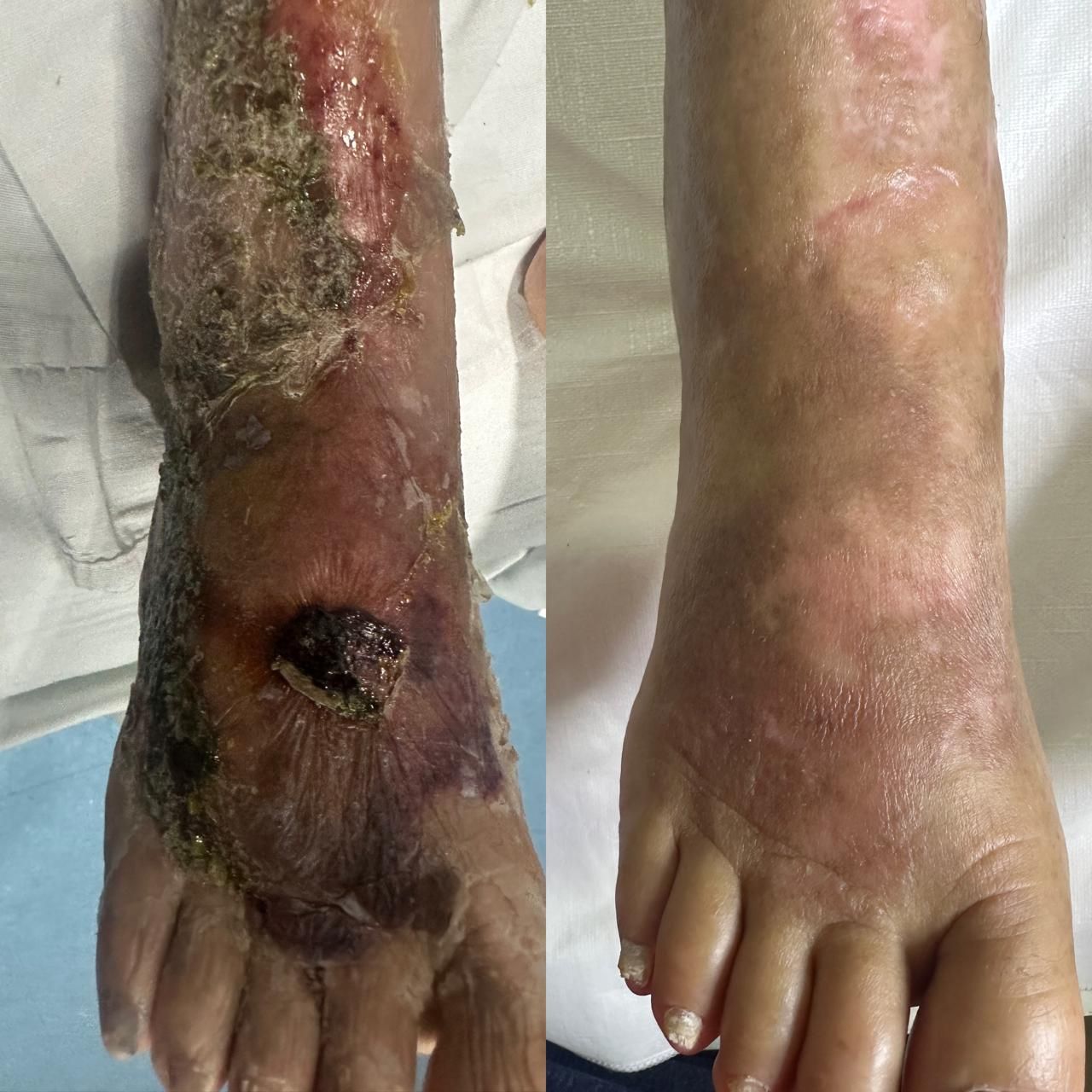 Jhonatan López González-63