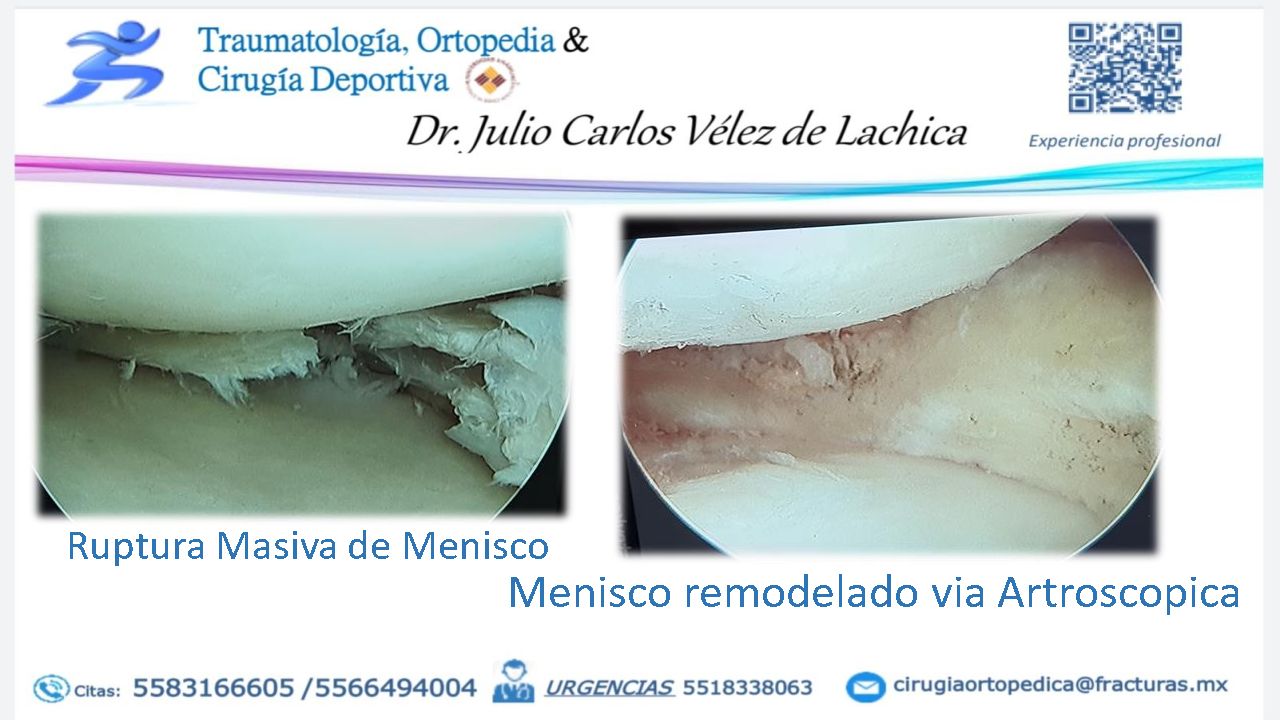 Julio Carlos Vélez De Lachica-14