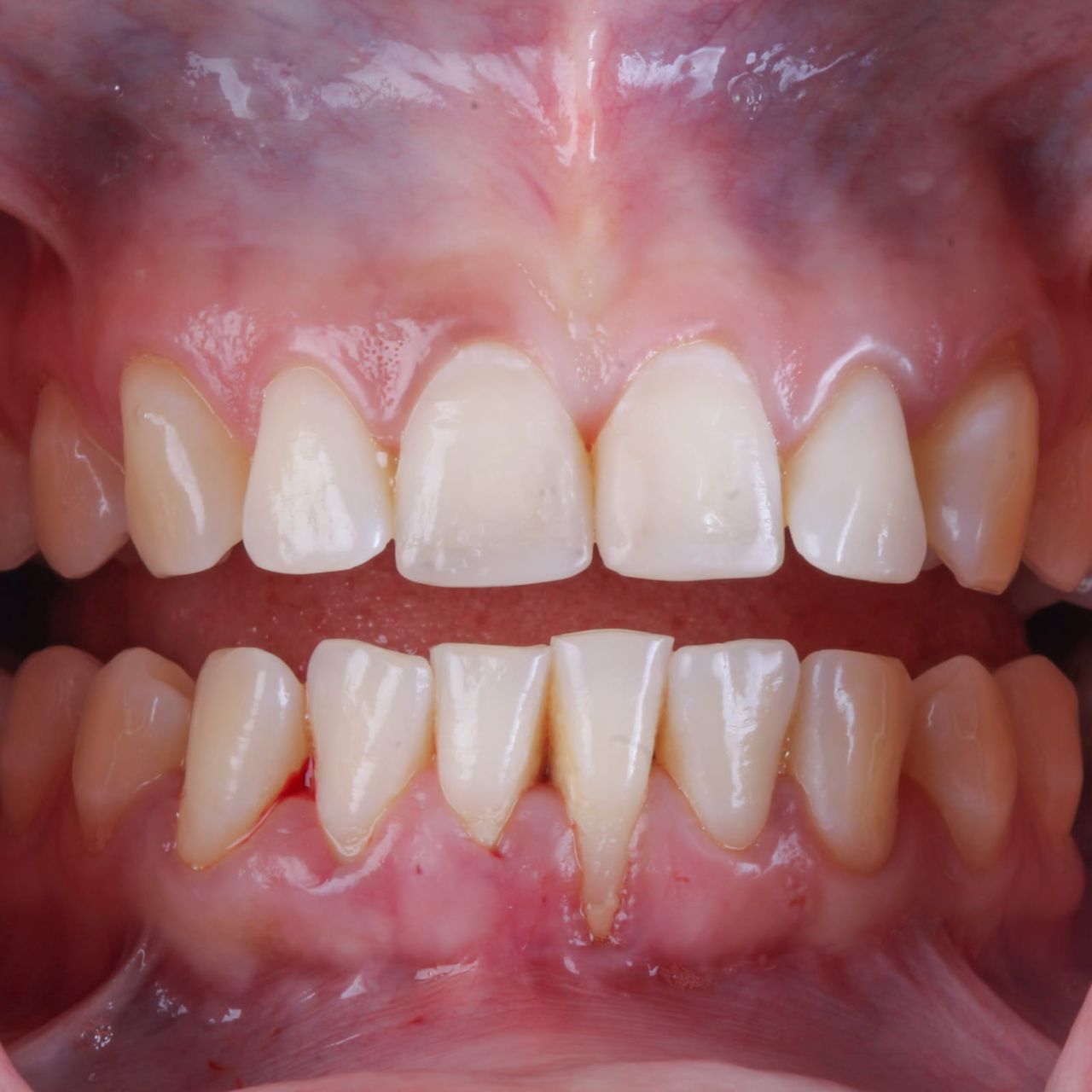 Hugo Enrique Aguilar Lamas-42