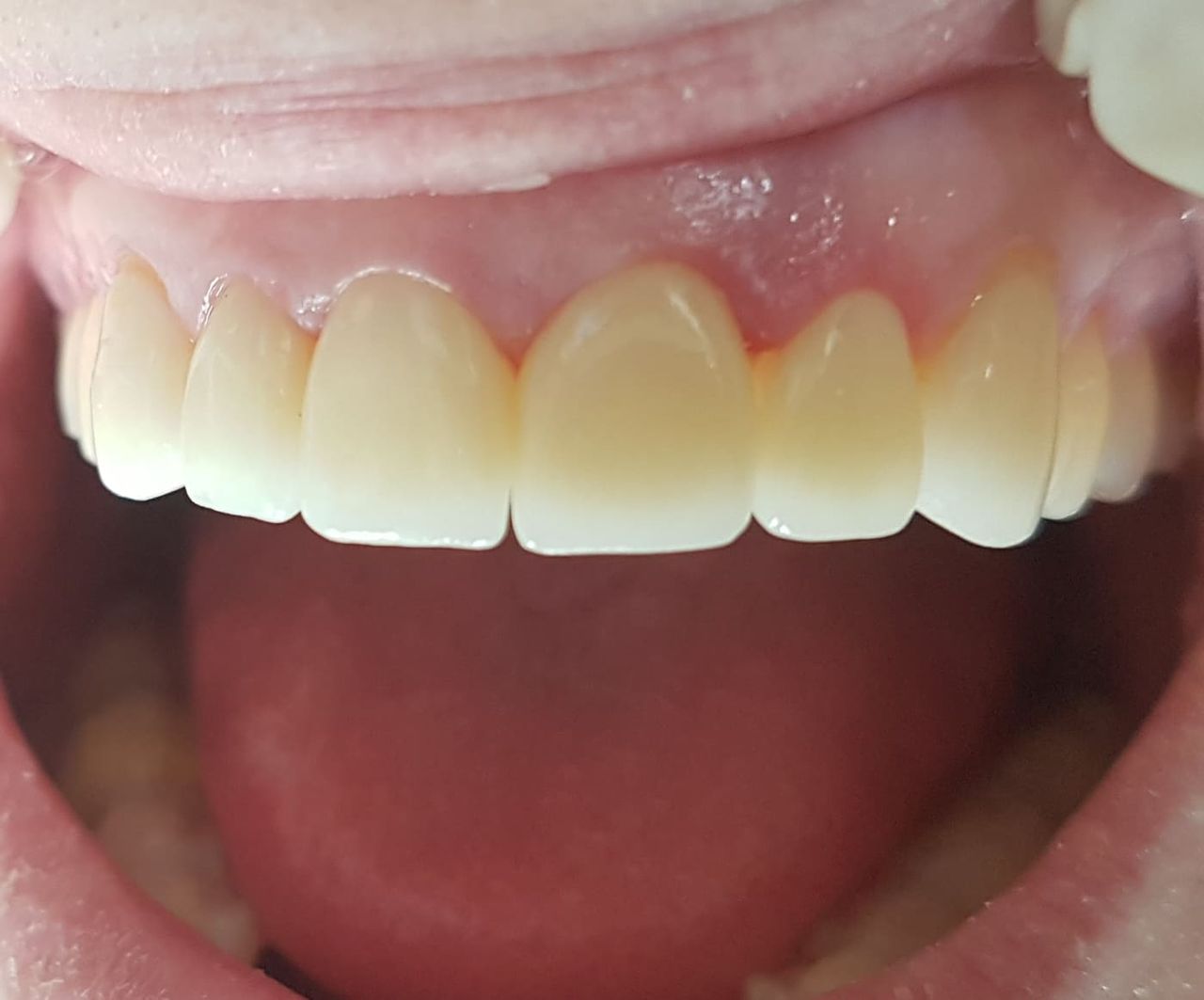 Edmundo Zoquiapa Martinez-0