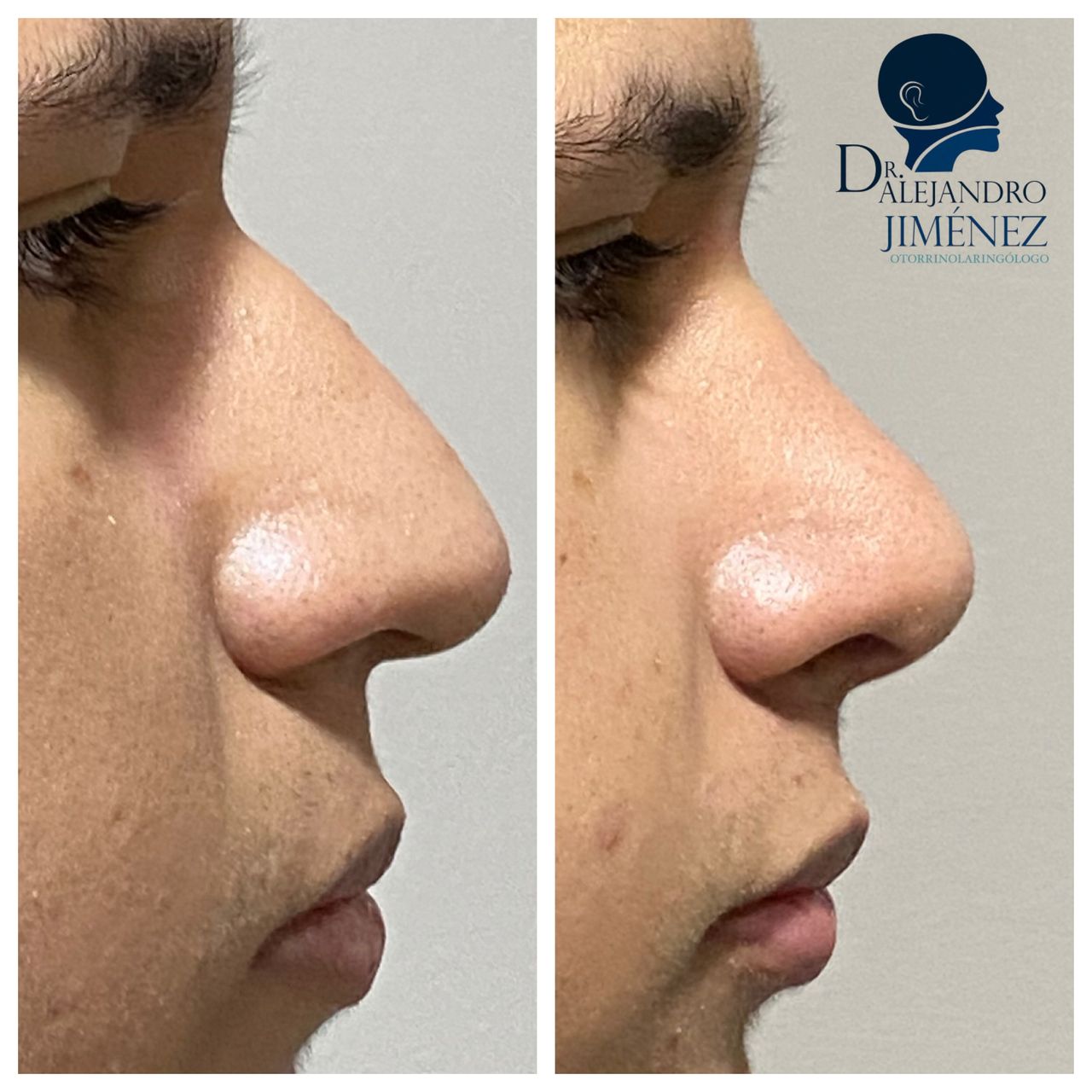 Alejandro Jimenez Garcia-30