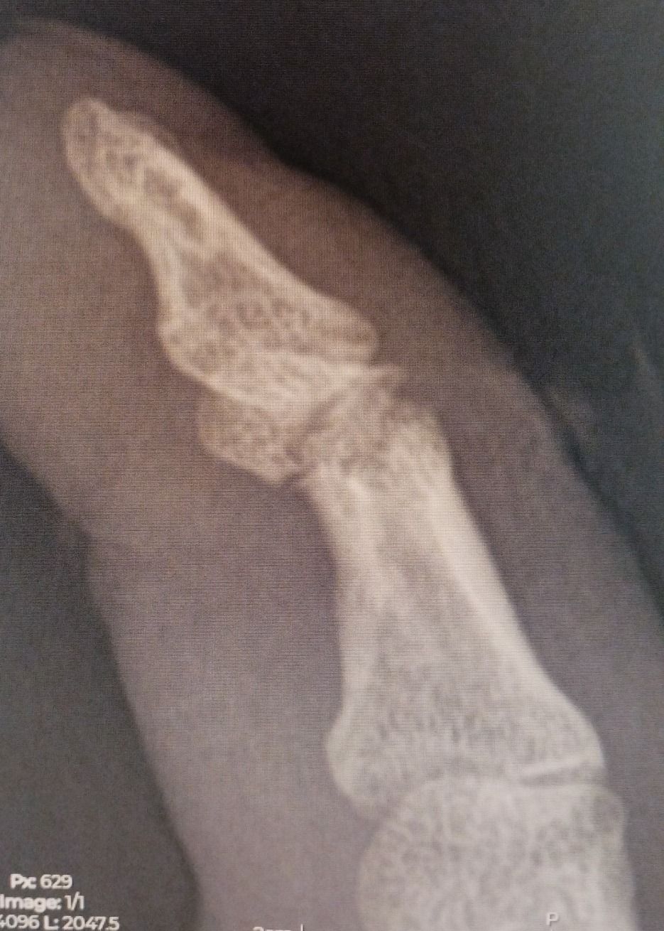 Leonardo Isaac Re-20