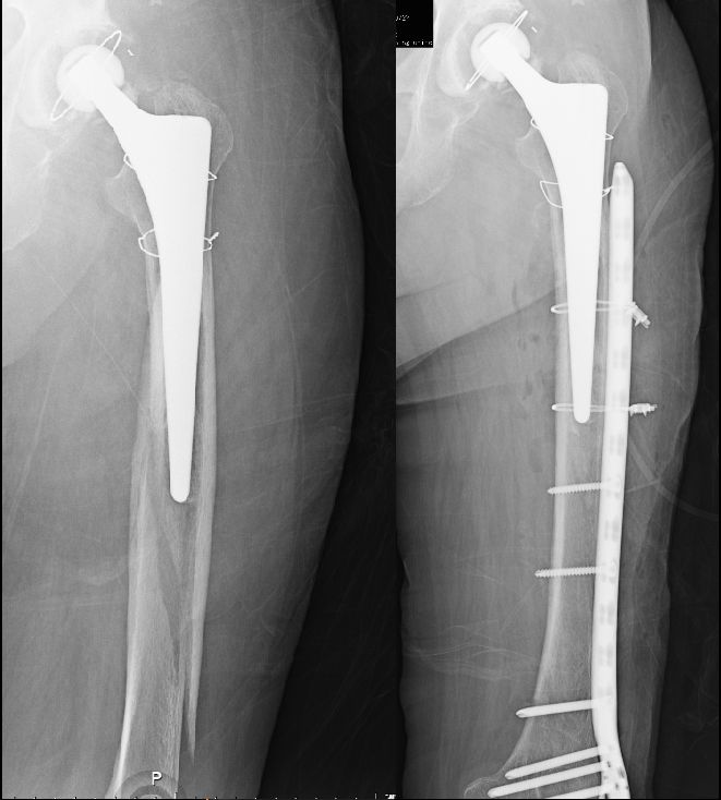 Diego Armando Contreras Rojas-13