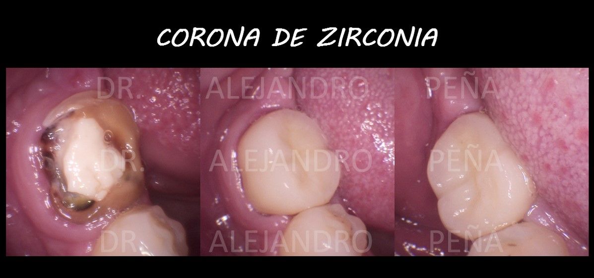 Alejandro Peña Vega-11