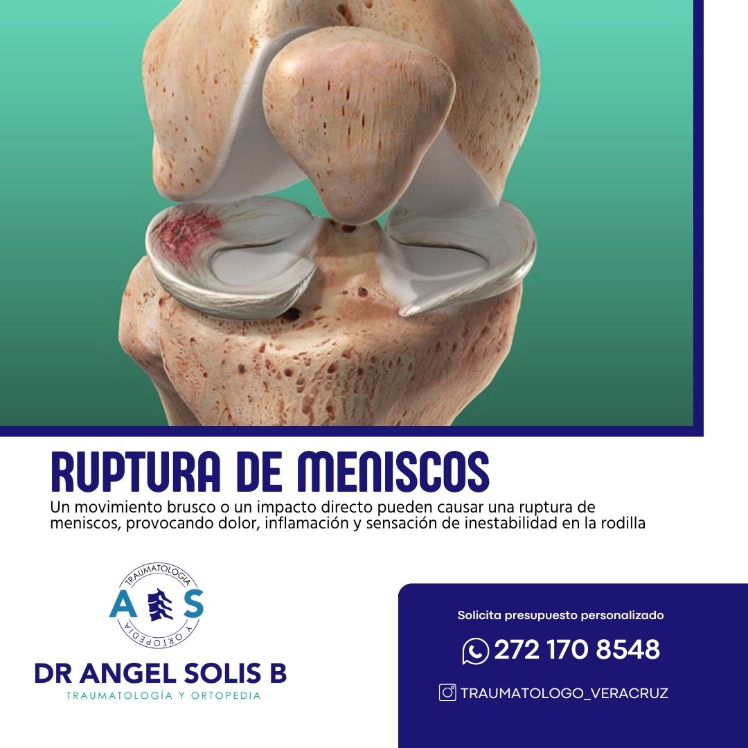 Angel Alberto Solis Barrios-3