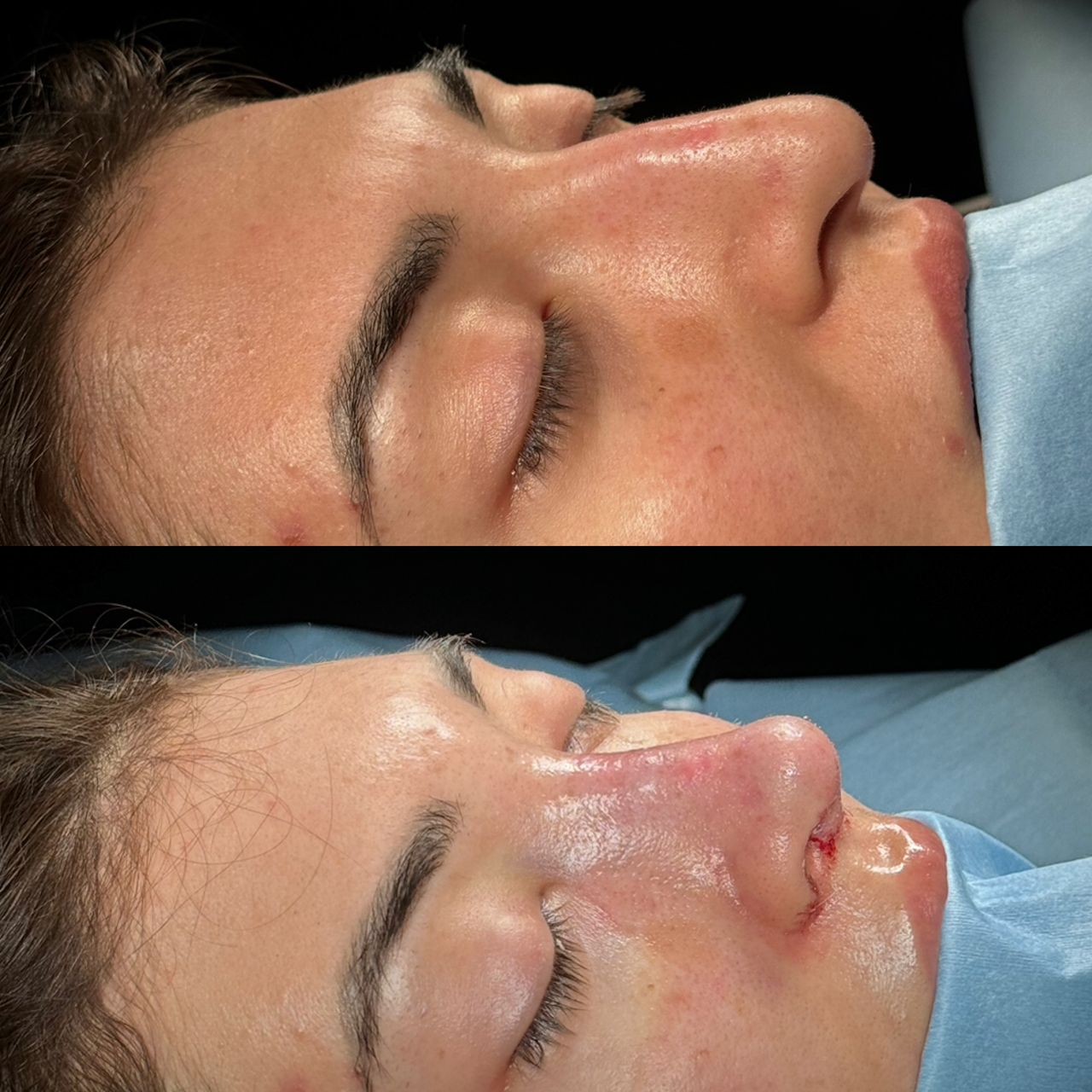 Angel Castro Urquizo-98